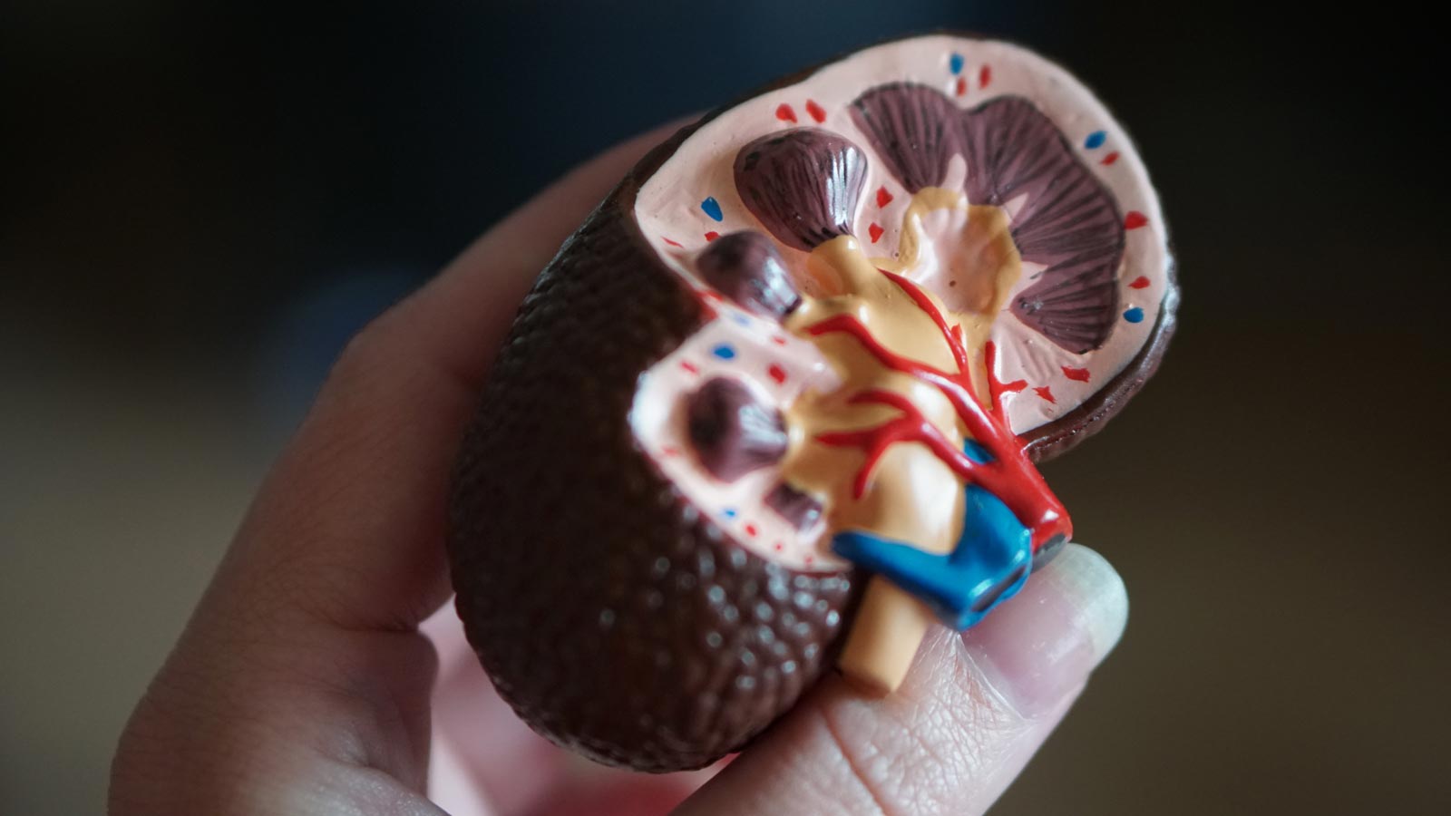 Ce cauzează pietre la rinichi si ce trebuie să faceți